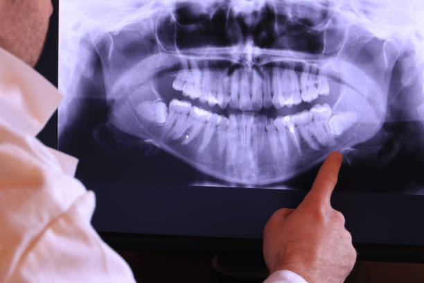 Best Pediatric Emergency Dentist in Gray, LA