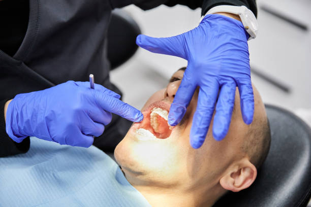 Best Emergency Root Canal Treatment in Gray, LA